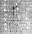 DE5025-tl77_4 - Typ:0 - ID: 153921 - Eintrag Nr.: 3 Wasserzeichen DE5025-tl77_4