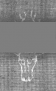 Wasserzeichen DE5025-tl172_73