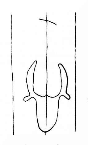 DE4200-StBlasien96_135
