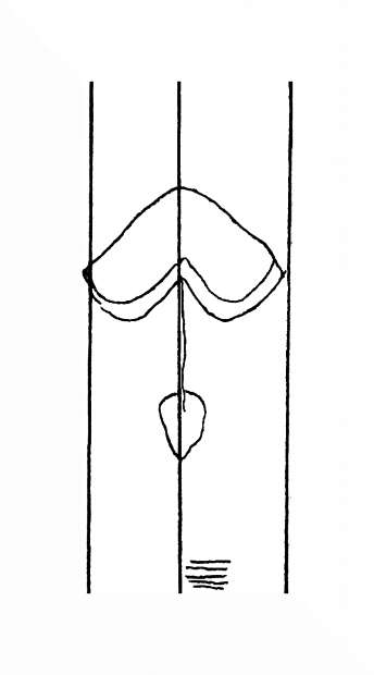 DE8310-Mc106_246
