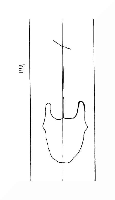 DE8310-Mc115_120
